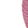 Wpływ stałej stymulacji serca na wybrane parametry hemodynamiczne - obrazek 2